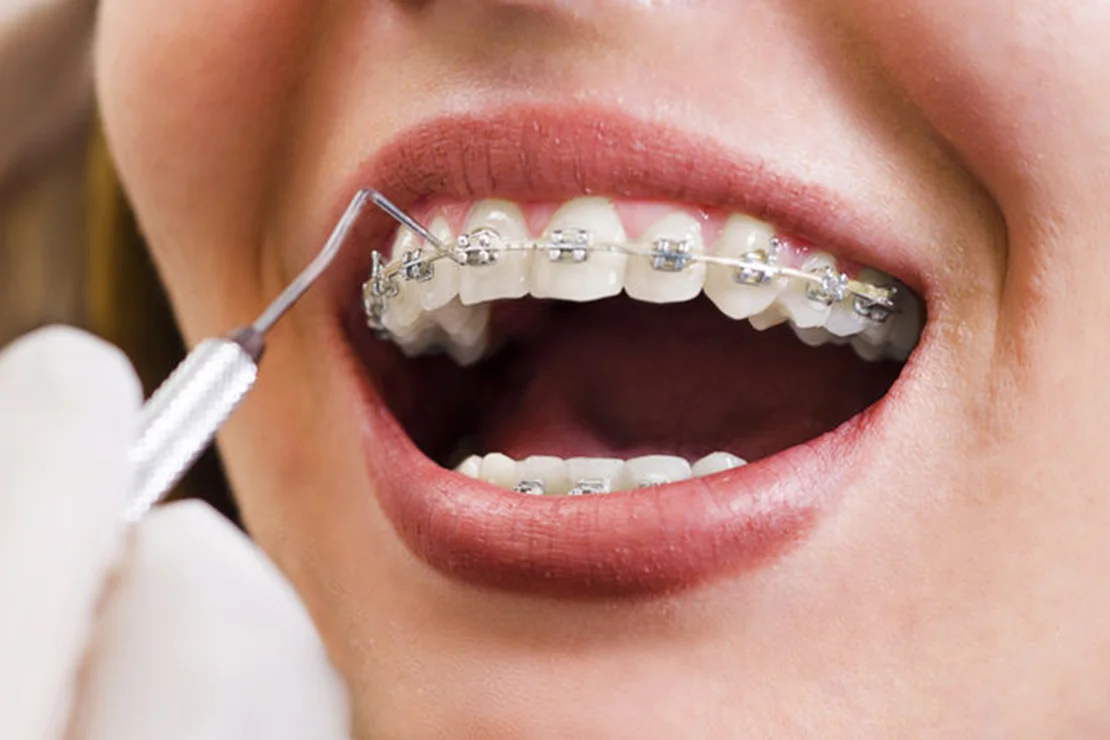 estetica-dentara-ploiesti